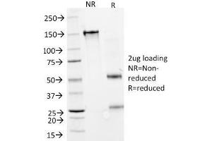 SDS-PAGE Analysis Purified IFNA2 Mouse Monoclonal Antibody (N27). (IFNA2 Antikörper)