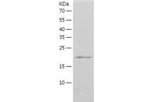 Western Blotting (WB) image for RAB13, Member RAS Oncogene Family (RAB13) (AA 1-200) protein (His tag) (ABIN7124736)