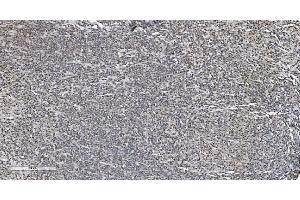 IHC analysis of HP1 alpha/CBX5 using anti-HP1 alpha/CBX5 antibody (ABIN7599057). (CBX5 Antikörper  (AA 1-191))