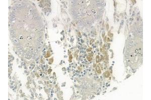 ABIN6259448 and ABIN6275352 at 1/100 staining human normal colon tissue by IHC-P. (PEX2 Antikörper  (Internal Region))