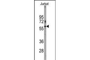 Western blot analysis of anti-PFKFB1 Antibody (N-term) (ABIN392771 and ABIN2842215) in Jurkat cell line lysates (35 μg/lane). (PFKFB1 Antikörper  (N-Term))
