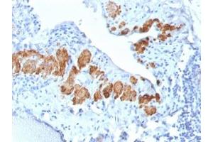 IHC testing of FFPE human breast tissue with recombinant SMMHC antibody (clone MYH11/2303R). (MYH11 Antikörper)
