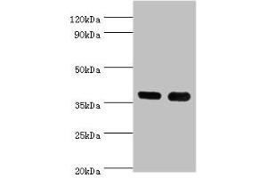 Western blot All lanes: CD1A antibody at 6 μg/mL Lane 1: K562 whole cell lysate Lane 2: Mouse thymus tissue Secondary Goat polyclonal to rabbit IgG at 1/10000 dilution Predicted band size: 37 kDa Observed band size: 37 kDa (CD1a Antikörper  (AA 21-181))