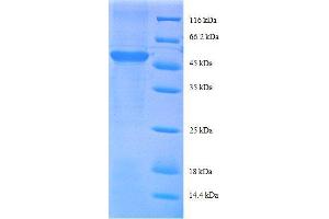 Ribosomal Protein S9 (RPS9) (AA 2-184), (partial) protein (GST tag)