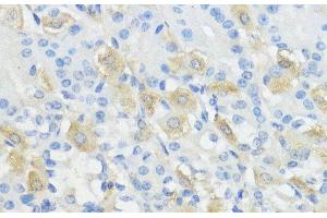 Immunohistochemistry of paraffin-embedded Mouse stomach using GPX2 Polyclonal Antibody at dilution of 1:100 (40x lens). (Glutathione Peroxidase 2 Antikörper)