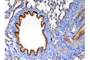 Immunohistochemistry (IHC) image for anti-Matrix Metallopeptidase 13 (Collagenase 3) (MMP13) (AA 99-335) antibody (ABIN5693125)