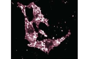Immunofluorescent staining of HeLa cells. (Ezrin Antikörper  (AA 391-515))