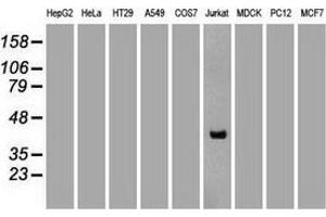 Western blot analysis of extracts (35 µg) from 9 different cell lines by using anti-CD2 monoclonal antibody. (CD2 Antikörper)
