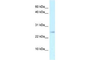 WB Suggested Anti-Arpp21 Antibody   Titration: 1. (ARPP21 Antikörper  (N-Term))