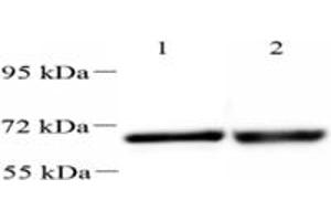 Western blot analysis of UCKL1 (ABIN7076157),at dilution of 1: 2000,Lane 1: HeLa cell lysate,Lane 2: Mouse kidney tissue lysate (UCKL1 Antikörper)