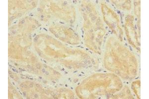 Immunohistochemistry (IHC) image for anti-Tumor Necrosis Factor (Ligand) Superfamily, Member 15 (TNFSF15) (AA 72-251) antibody (ABIN7173811)