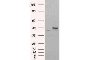Western Blotting (WB) image for anti-Flotillin 1 (FLOT1) antibody (ABIN5866203) (Flotillin 1 Antikörper)
