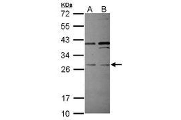 PLEKHF2 抗体  (AA 60-249)