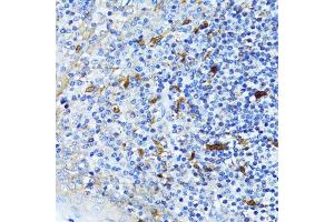 Immunohistochemistry of paraffin-embedded human tonsil using CTNNB1 antibody. (CTNNB1 Antikörper  (AA 1-100))