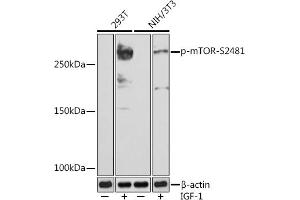 Western blot analysis of extracts of various cell lines, using Phospho-mTOR-S2481 (ABIN7268436) at 1:1000 dilution. (MTOR Antikörper  (pSer2481))