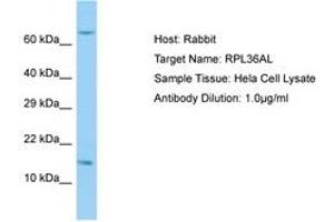 Image no. 1 for anti-Ribosomal Protein L36a-Like (RPL36AL) (C-Term) antibody (ABIN6749891) (RPL36AL Antikörper  (C-Term))