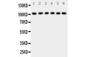 Western Blotting (WB) image for anti-Nuclear Factor of kappa Light Polypeptide Gene Enhancer in B-Cells 1 (NFKB1) (AA 778-797), (C-Term) antibody (ABIN3042654)