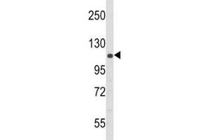 Western blot analysis of PERK antibody and 293 lysate (PERK Antikörper  (AA 148-175))