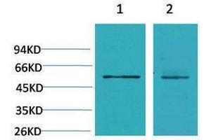 Western Blotting (WB) image for anti-Calcium Channel, Voltage-Dependent, beta 3 Subunit (CACNB3) antibody (ABIN3188037) (CACNB3 Antikörper)