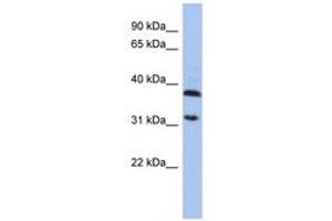 Image no. 1 for anti-Aspartoacylase (ASPA) (AA 143-192) antibody (ABIN6743963) (ASPA Antikörper  (AA 143-192))