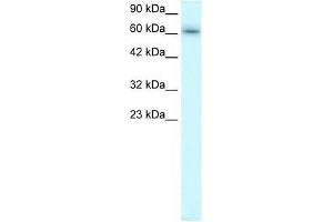Western Blotting (WB) image for anti-TRAF-Type Zinc Finger Domain Containing 1 (TRAFD1) (C-Term) antibody (ABIN927405)