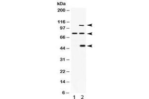 Western blot testing of 1) rat brain and 2) human 293 lysate with PACE4 antibody. (PCSK6 Antikörper)