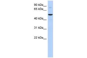 WB Suggested Anti-HTATIP Antibody Titration: 0. (KAT5 Antikörper  (Middle Region))