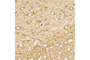 Immunohistochemistry of paraffin-embedded mouse brain using NgR3 Rabbit mAb (ABIN7269932) at dilution of 1:50 (40x lens). (RTN4RL1 Antikörper)