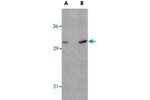 Western blot analysis of ATG12 in human brain tissue lysate with ATG12 polyclonal antibody  at (A) 0. (ATG12 Antikörper  (N-Term))