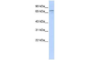 WB Suggested Anti-NRG3 Antibody Titration:  0. (Neuregulin 3 Antikörper  (Middle Region))