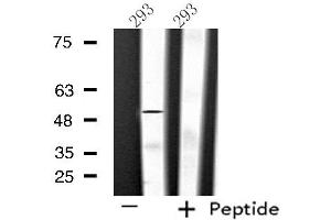 Western blot analysis of extracts from 293 cells using SLC39A7 antibody.