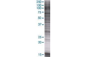 AXL transfected lysate. (AXL 293T Cell Transient Overexpression Lysate(Denatured))