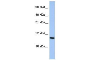 WB Suggested Anti-ARL5A Antibody Titration: 0. (ARL5A Antikörper  (Middle Region))