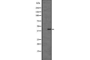 Western blot analysis of CMKLR1 expression in HL60 cell lysate ;,The lane on the left is treated with the antigen-specific peptide. (CMKLR1 Antikörper  (Internal Region))