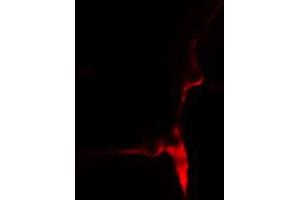 ABIN6269003 staining HeLa cells by IF/ICC. (COL3A1 Antikörper  (N-Term))