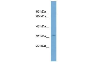 Western Blot showing KRCC1 antibody used at a concentration of 1-2 ug/ml to detect its target protein. (KRCC1 Antikörper  (N-Term))