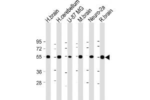 All lanes : Anti-NRXN1 Antibody (N-term) at 1:2000 dilution Lane 1: Human brain lysate Lane 2: Human cerebellum lysate Lane 3: U-87 MG whole cell lysate Lane 4: Mouse brain lysate Lane 5: Neuro-2a whole cell lysate Lane 6: Rat brain lysate Lysates/proteins at 20 μg per lane. (Neurexin 1 Antikörper  (N-Term))