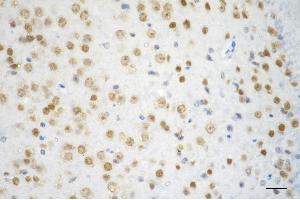 Immunohistochemistry was performed on paraffin-embedded mouse brain using chromodomain helicase DNA binding protein 3 antibody (ABIN7798068), 1:200). (Rekombinanter CHD3 Antikörper)