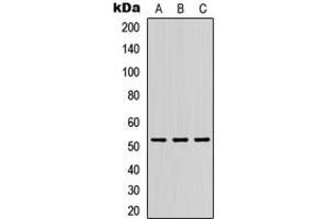Western blot analysis of DMRTA1 expression in HEK293T (A), Raw264. (DMRTA1 Antikörper  (Center))