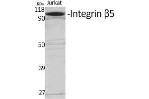 Western Blot analysis of various cells using Integrin β5 Polyclonal Antibody diluted at 1:1000. (Integrin beta 5 Antikörper  (AA 690-770))