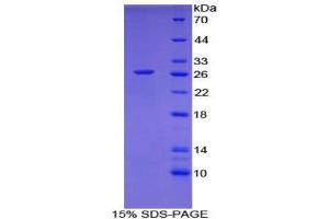 SDS-PAGE (SDS) image for CD302 (CD302) (AA 21-225) protein (His tag) (ABIN1879496)
