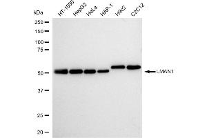 Western blotting analysis using LMAN1 antibody (ABIN7799244).