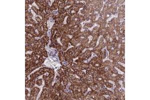 Immunohistochemical staining of human liver with FBRS polyclonal antibody  shows strong cytoplasmic positivity in hepatocytes at 1:20-1:50 dilution. (Fibrosin Antikörper)