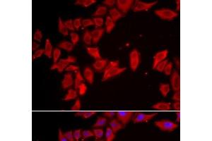 Immunofluorescence analysis of HeLa cells using SLC35A2 Polyclonal Antibody (SLC35A2 Antikörper)
