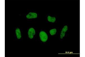 Immunofluorescence of  purified  MaxPab antibody to BRD3 on HeLa cell. (BRD3 Antikörper  (AA 1-556))