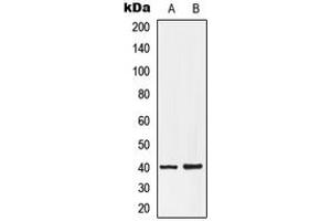 Western blot analysis of EDG7 expression in HepG2 (A), NT2D1 (B) whole cell lysates. (LPAR3 Antikörper  (C-Term))