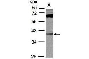 WB Image Sample (30μg whole cell lysate) A:Raji , 10% SDS PAGE antibody diluted at 1:1000
