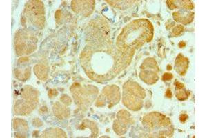 Immunohistochemistry of paraffin-embedded human pancreatic tissue using ABIN7143956 at dilution of 1:100 (ALS2 Antikörper  (AA 1-280))