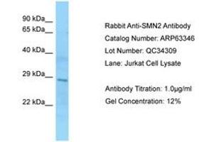 Image no. 1 for anti-SMN1 / SMN2 (AA 51-100) antibody (ABIN6749971) (SMN1 / SMN2 (AA 51-100) Antikörper)