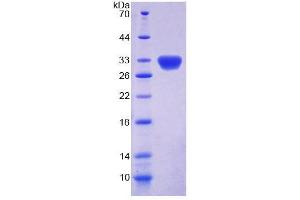SDS-PAGE (SDS) image for Dyskeratosis Congenita 1, Dyskerin (DKC1) (AA 298-509) protein (His tag) (ABIN6239095)